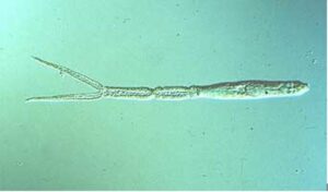 A microscopic parasite